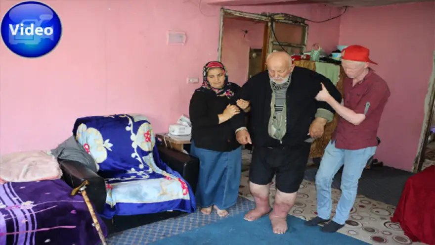 Ayakları şiş, yürüyemiyor yetkililerden yardım istiyor