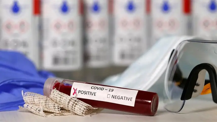 Ereğli'de 1 Günde 17 Pozitif vaka!