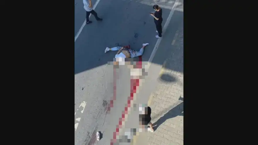 Alaplı'da ağır yaralanan motosiklet sürücüsü hayata tutunamadı...