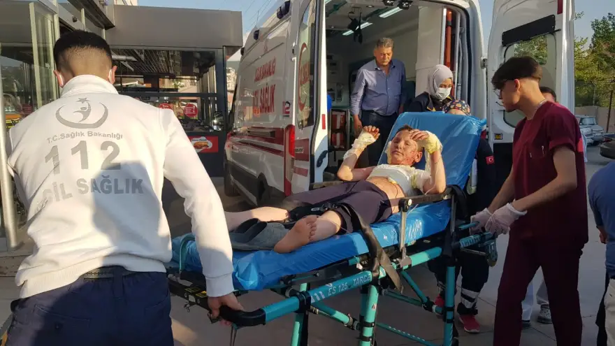 8 Yaşındaki çocuk feci şekilde yandı 