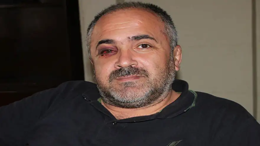 4 KİŞİ TARAFINDAN DARP EDİLDİ